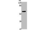 Western Blot analysis of K562 cells using FTO Polyclonal Antibody