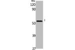 Western Blot analysis of K562 cells using GDI-1 Polyclonal Antibody