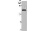 Western Blot analysis of rat kidney cells using Aladin Polyclonal Antibody