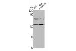 Western Blot analysis of rat stomach 293 cells using DFNA5 Polyclonal Antibody