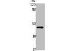 Western Blot analysis of K562 cells using AR-