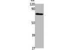 Western Blot analysis of K562 cells using ABCG1 Polyclonal Antibody