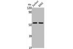 Western Blot analysis of Jurkat K562 cells using BAGE5 Polyclonal Antibody