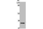 Western Blot analysis of Jurkat cells using FAIM2 Polyclonal Antibody