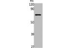Western Blot analysis of Jurkat cells using GABAA Re Polyclonal Antibody