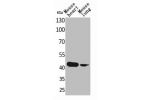 Western Blot analysis of mouse heart mouse lung cells using Actin-a cardiac muscle Polyclonal Antibody