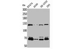 Western Blot analysis of BT474 A549 SHSY5Y 293 cells using K-cadherin Polyclonal Antibody