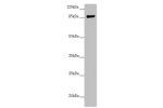 Western blot<br />
All lanes:CCHCR1 antibody at 2.67 ug/ml+ 293T whole cell lysate<br />
Secondary<br />
Goat polyclonal to rabbit IgG at 1/10000 dilution<br />
Predicted band size: 89,100,96 kDa<br />
Observed band size: 89 kDa<br />