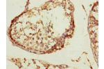 Immunohistochemistry of paraffin-embedded human kidney tissue using CSB-PA004769ESR2HU at dilution of 1:100