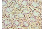 Immunohistochemistry of paraffin-embedded human rectum tissue using CSB-PA004771ESR2HU at dilution 1:100