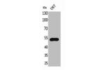 Western Blot analysis of U87 cells using Fractalkine Receptor Polyclonal Antibody