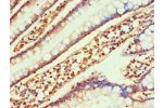 Immunohistochemistry of paraffin-embedded human small intestine using CSB-PA004789ESR2HU at dilution 1:100