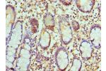 Immunohistochemistry of paraffin-embedded human small intestine using CSB-PA004802ESR1HU at dilution 1:100