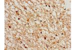 Immunohistochemistry of paraffin-embedded human brain tissue using CSB-PA004804LA01HU at dilution of 1:100