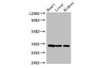 Western Blot<br />
Positive WB detected in:Mouse heart tissue,Mouse liver tissue,Mouse kidney tissue<br />
All lanes:CCND2 antibody at 3.5ug/ml<br />
Secondary<br />
Goat polyclonal to rabbit IgG at 1/50000 dilution<br />
Predicted band size: 34,25 kDa<br