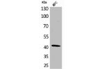 Western Blot analysis of MCF cells using a-SMA Polyclonal Antibody