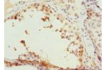 Immunohistochemistry of paraffin-embedded human testis tissue using CSB-PA004818ESR2HU at dilution 1:100