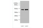 Western blot<br />
All lanes: CCNJL antibody at 3ug/ml<br />
Lane 1 : U251 whole cell lysate<br />
Lane 2 : Mouse liver tissue<br />
Secondary<br />
Goat polyclonal to Rabbit IgG at 1/10000 dilution<br />
Predicted band size: 49,19 kDa<br />
Observed band