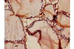 Immunohistochemistry of paraffin-embedded human thyroid tissue using CSB-PA004832LA01HU at dilution of 1:100