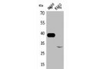 Western Blot analysis of H460 K562 cells using Cathepsin L Polyclonal Antibody