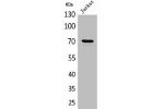 Western Blot analysis of Jurkat cells using Prothrombin Polyclonal Antibody