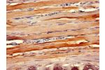 Immunohistochemistry of paraffin-embedded human skeletal muscle tissue using CSB-PA004840LA01HU at dilution of 1:100
