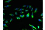 Immunofluorescent analysis of Hela cells using CSB-PA004843LA01HU at a dilution of 1:100 and Alexa Fluor 488-congugated AffiniPure Goat Anti-Rabbit IgG(H+L)