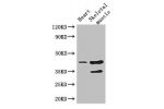 Western Blot<br />
Positive WB detected in:Mouse heart tissue,Mouse skeletal muscle tissue<br />
All lanes: Ccr5 antibody at 3ug/ml<br />
Secondary<br />
Goat polyclonal to rabbit IgG at 1/50000 dilution<br />
Predicted band size: 41 kDa<br />
Observed ba