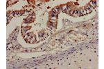 Immunohistochemistry analysis of human lung tissue using CSB-PA004846LA01HU at dilution of 1:100