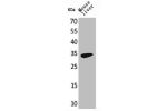Western Blot analysis of mouse liver cells using Hepassocin Polyclonal Antibody