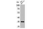 Western Blot analysis of rat muscle cells using CA IV Polyclonal Antibody