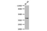 Western Blot<br />
Positive WB detected in:HL60 whole cell lysate<br />
All lanes:CCRL2 antibody at 2.5