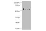 Western blot<br />
All lanes:CCT5 antibody at 1.78ug/ml<br />
Lane 1:Hela whole cell lysate<br />
Lane 2:Colo320 whole cell lysate<br />
Secondary<br />
Goat polyclonal to rabbit at 1/10000 dilution<br />
Predicted band size: 60,50 kDa<br />
Observed band