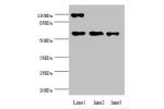 Western blot<br />
All lanes:CCT5 antibody at 1.84ug/ml<br />
Lane 1:Hela whole cell lysate<br />
Lane 2:Colo320 whole cell lysate<br />
Lane 3:mouse ovarian tissue<br />
Secondary<br />
Goat polyclonal to rabbit at 1/10000 dilution<br />
Predicted band s