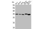Western Blot analysis of Raji BT474 K562 mouse heart mouse skeletal muscle cells using Claudin-17 Polyclonal Antibody