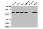 Western Blot<br />
Positive WB detected in:Jurkat whole cell lysate,Raji whole cell lysate,Hela whole cell lysate,HEK293 whole cell lysate,NIH/3T3 whole cell lysate,K562 whole cell lysate<br />
All lanes: CCT8 antibody at 3ug/ml<br />
Secondary<br />
Goat