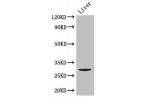 Western Blot<br />
Positive WB detected in:Mouse liver tissue<br />
All lanes: CD151 antibody at 2.8ug/ml<br />
Secondary<br />
Goat polyclonal to rabbit IgG at 1/50000 dilution<br />
Predicted band size: 29 kDa<br />
Observed band size: 29 kDa<br />