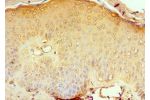 Immunohistochemistry of paraffin-embedded human skin tissue using CSB-PA004889ESR1HU at dilution 1:100