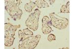 Immunohistochemistry of paraffin-embedded human placenta tissue using CSB-PA004895ESR1HU at dilution 1:100