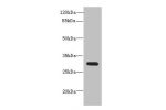 Western blot<br />
All lanes: CD200antibody at 0.71ug/ml+ Mouse kidney tissue<br />
Goat polyclonal to rabbit at 1/10000 dilution<br />
Predicted band size: 32,31,33 kDa<br />
Observed band size: 31 kDa<br />