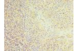 Immunohistochemistry of paraffin-embedded human tonsil using CSB-PA004900ESR1HUat dilution 1:100