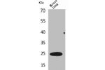 Western Blot analysis of mouse lung cells using ET-1 Polyclonal Antibody