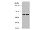 All lanes:Myeloid cell surface antigen CD33 antibody at 8ug/ml<br />
Lane 1:K562 whole cell lysate<br />
Lane 2:HepG2 whole cell lysate<br />
Secondary<br />
Goat polyclonal to rabbit at 1/10000 dilution<br />
Predicted band size: 40,34,26 kDa<br />
Obser
