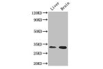 Western Blot<br />
Positive WB detected in:Mouse liver tissue,Mouse brain tissue<br />
All lanes: CD37 antibody at 2.7ug/ml<br />
Secondary<br />
Goat polyclonal to rabbit IgG at 1/50000 dilution<br />
Predicted band size: 32,24,23 kDa<br />
Observed band