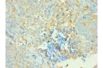 Immunohistochemistry of paraffin-embedded human tonsil using CSB-PA004929ESR1HU at dilution 1:100