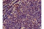 Immunohistochemistry of paraffin-embedded human lymph node tissue using CSB-PA004931HA01HU at dilution of 1:100