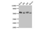 Western Blot<br />
Positive WB detected in:Hela whole cell lysate,293 whole cell lysate,U87 whole cell lysate,Rat brain tissue<br />
All lanes:CD3EAP antibody at 3.9