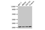 Western Blot<br />
Positive WB detected in:MCF-7 whole cell lysate,HEK293 whole cell lysate,NIH/3T3 whole cell lysate,Rat stomach tissue<br />
All lanes:CD3G antibody at 2