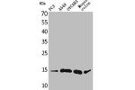 Western Blot analysis of PC-3 A549 OVCAR3 mouse colon cells using Eotaxin-3 Polyclonal Antibody