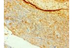 Immunohistochemistry of paraffin-embedded human tonsil using CSB-PA004935ESR2HU at dilution 1:100